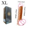 xl